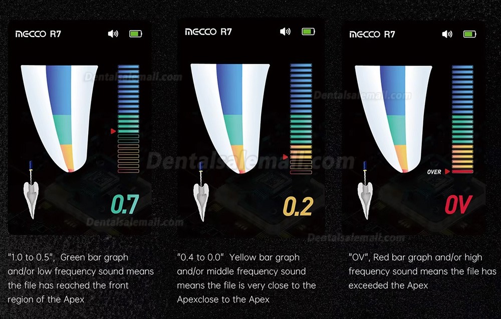Mecoo R7 Dental Foldable Apex Locator 3.5 Inches TFT Screen